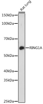 RING1A Rabbit Polyclonal Antibody - Image 2