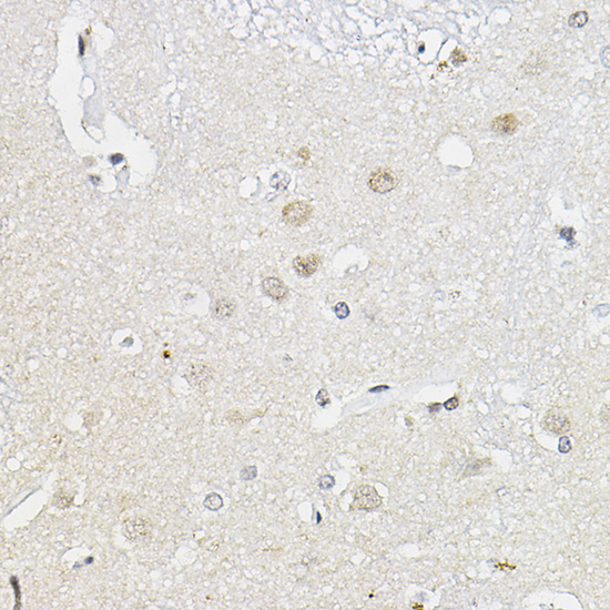 RING1A Rabbit Polyclonal Antibody - Image 3