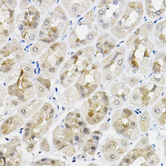 RING1A Rabbit Polyclonal Antibody - Image 4