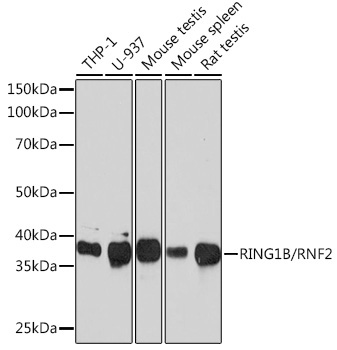 RING1B/RNF2 Rabbit Monoclonal Antibody