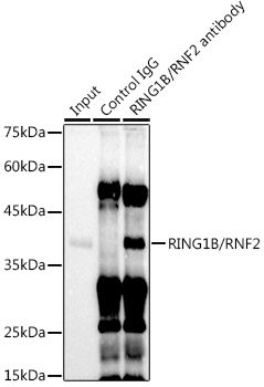 RING1B/RNF2 Rabbit Monoclonal Antibody - Image 2