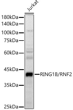RING1B/RNF2 Rabbit Polyclonal Antibody