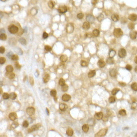 RING1B/RNF2 Rabbit Polyclonal Antibody - Image 2