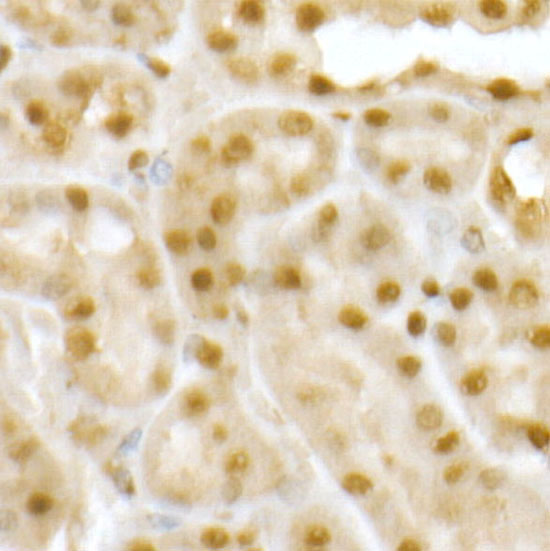 RING1B/RNF2 Rabbit Polyclonal Antibody - Image 3