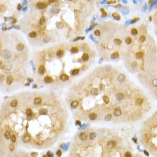 RING1B/RNF2 Rabbit Polyclonal Antibody - Image 4