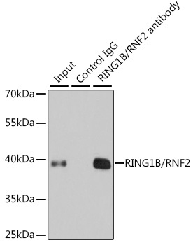 RING1B/RNF2 Rabbit Polyclonal Antibody - Image 5