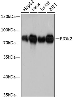 RIOK2 Rabbit Polyclonal Antibody