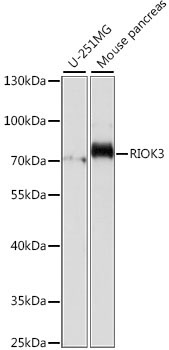 RIOK3 Rabbit Polyclonal Antibody