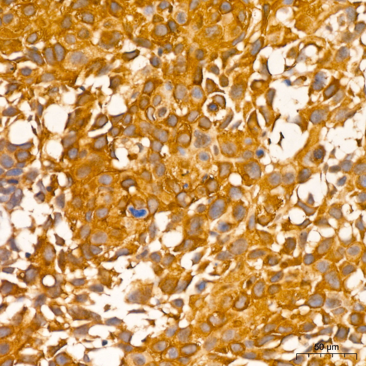 RIP3 Rabbit Polyclonal Antibody
