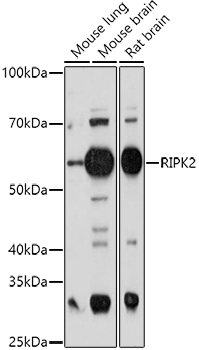 RIPK2 Rabbit Polyclonal Antibody