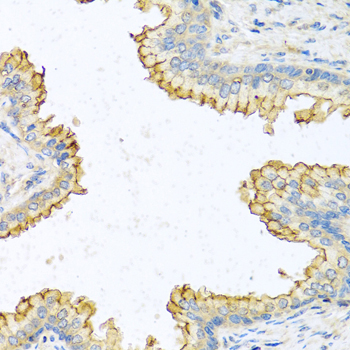 RNASE13 Rabbit Polyclonal Antibody - Image 2