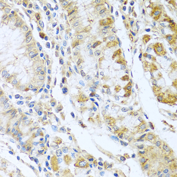RNASE13 Rabbit Polyclonal Antibody - Image 3