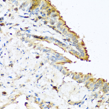 RNASE13 Rabbit Polyclonal Antibody - Image 4