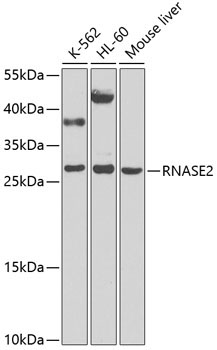 RNASE2 Rabbit Polyclonal Antibody