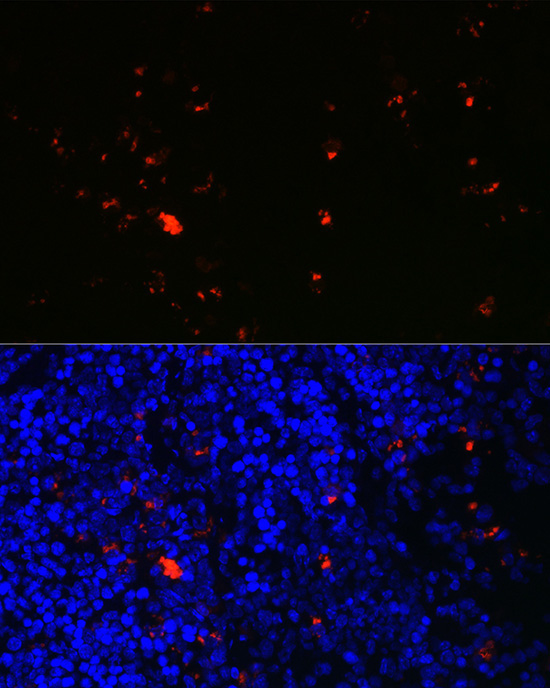 RNASE2 Rabbit Polyclonal Antibody - Image 2