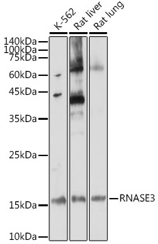RNASE3 Rabbit Polyclonal Antibody