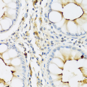 RNASE3 Rabbit Polyclonal Antibody