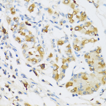 RNASE3 Rabbit Polyclonal Antibody - Image 2