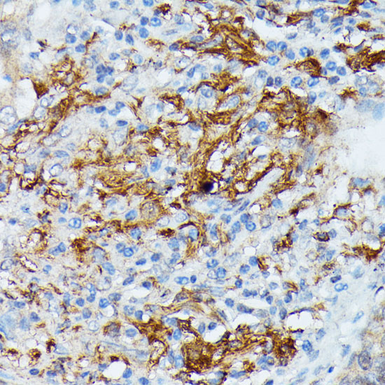 RNASE6 Rabbit Polyclonal Antibody - Image 2