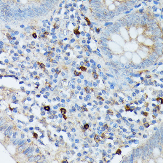 RNASE6 Rabbit Polyclonal Antibody - Image 3