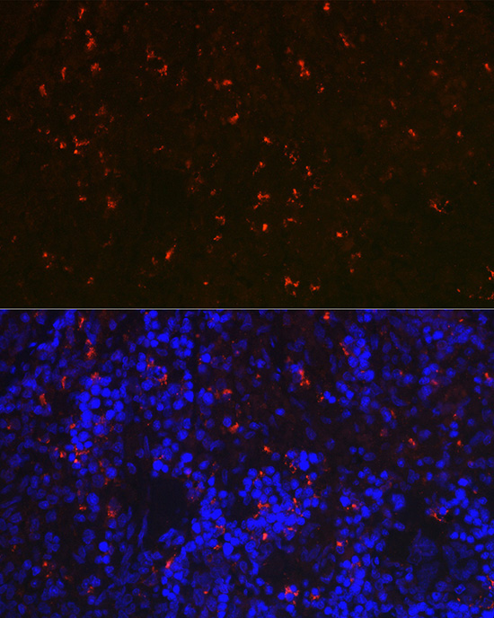RNASE6 Rabbit Polyclonal Antibody - Image 4