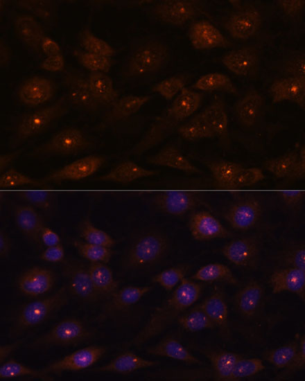 RNASEH2A Rabbit Polyclonal Antibody - Image 2