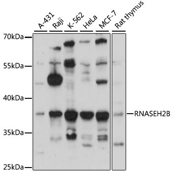 RNASEH2B Rabbit Polyclonal Antibody