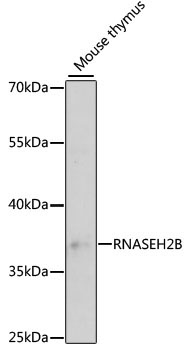 RNASEH2B Rabbit Polyclonal Antibody - Image 2