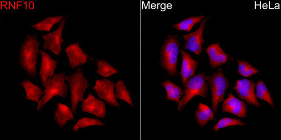RNF10 Rabbit Polyclonal Antibody - Image 2