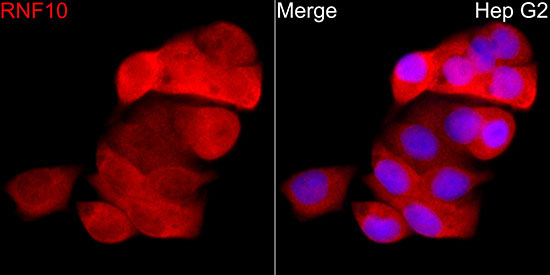 RNF10 Rabbit Polyclonal Antibody - Image 3