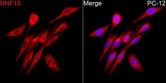 RNF10 Rabbit Polyclonal Antibody - Image 5