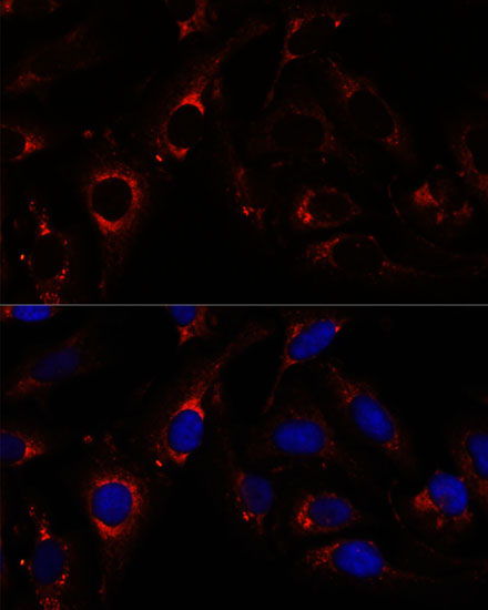RNF112 Rabbit Polyclonal Antibody - Image 4