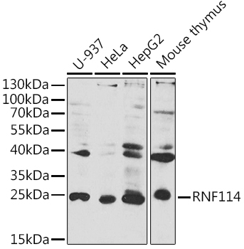 RNF114 Rabbit Polyclonal Antibody