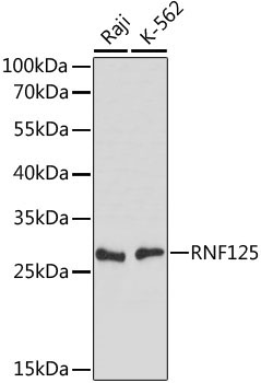 RNF125 Rabbit Polyclonal Antibody