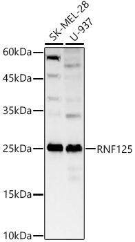 RNF125 Rabbit Polyclonal Antibody