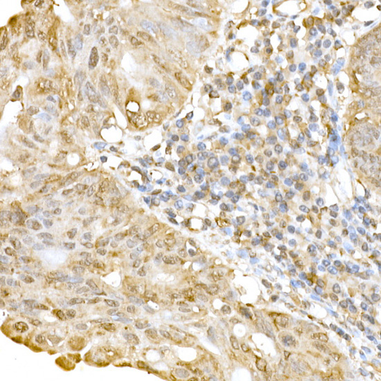RNF126 Rabbit Polyclonal Antibody - Image 2