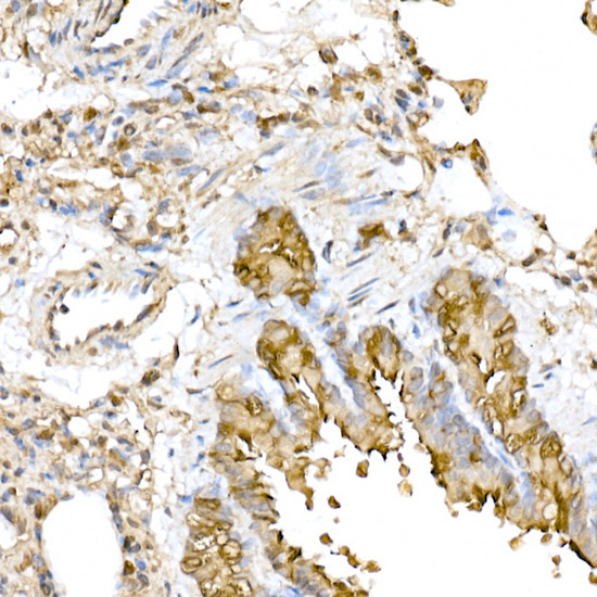 RNF126 Rabbit Polyclonal Antibody - Image 5