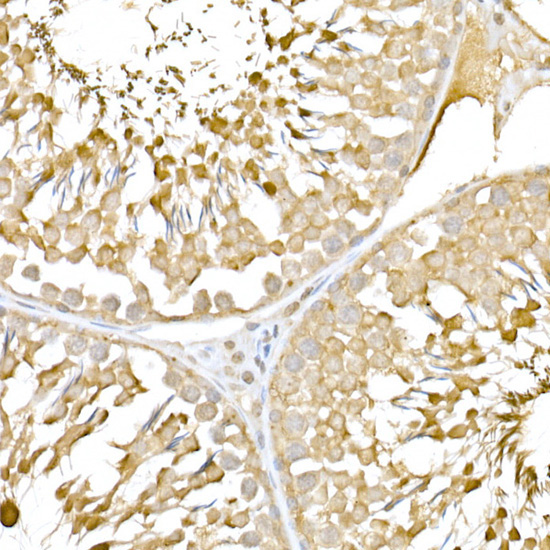 RNF126 Rabbit Polyclonal Antibody - Image 6