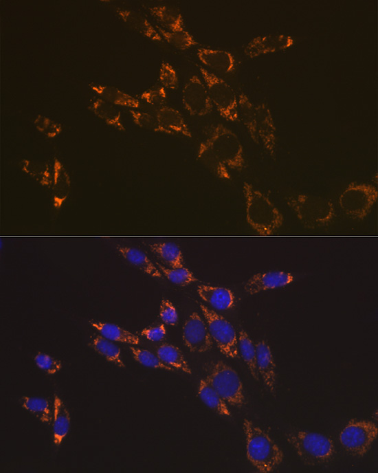 RNF126 Rabbit Polyclonal Antibody - Image 7