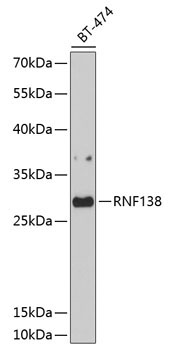 RNF138 Rabbit Polyclonal Antibody
