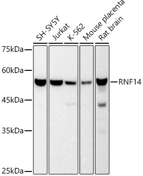 RNF14 Rabbit Monoclonal Antibody