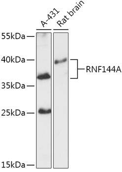 RNF144A Rabbit Polyclonal Antibody