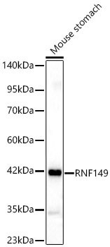 RNF149 Rabbit Polyclonal Antibody