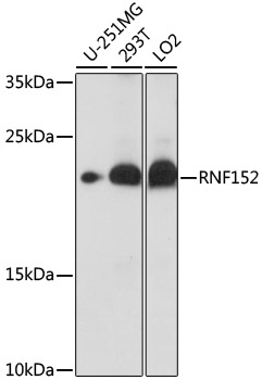 RNF152 Rabbit Polyclonal Antibody