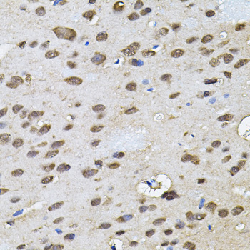 RNF166 Rabbit Polyclonal Antibody - Image 3