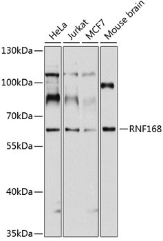 RNF168 Rabbit Polyclonal Antibody