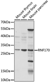 RNF170 Rabbit Polyclonal Antibody
