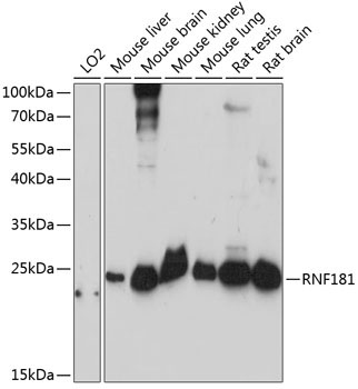 RNF181 Rabbit Polyclonal Antibody
