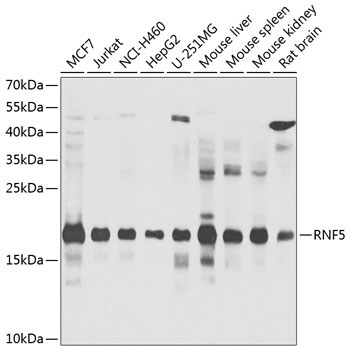 RNF5 Rabbit Polyclonal Antibody