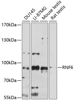 RNF6 Rabbit Polyclonal Antibody
